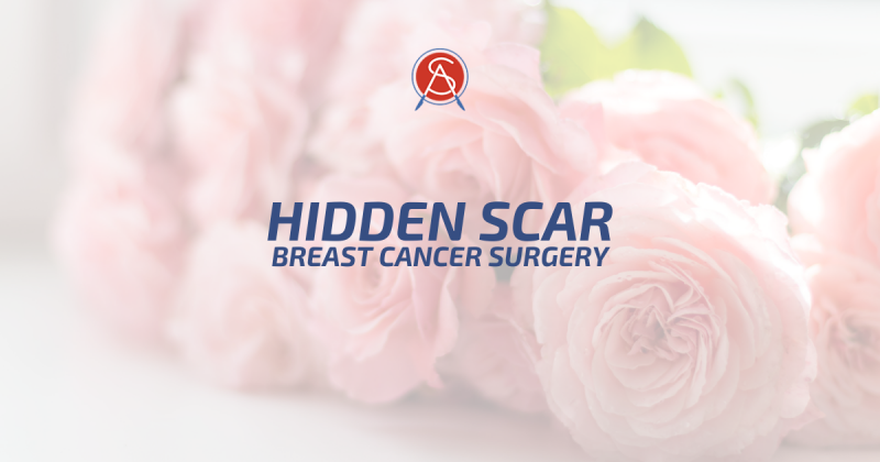 Dr. Dusty Smith Is Certified In Hidden Scar Breast Cancer Surgery