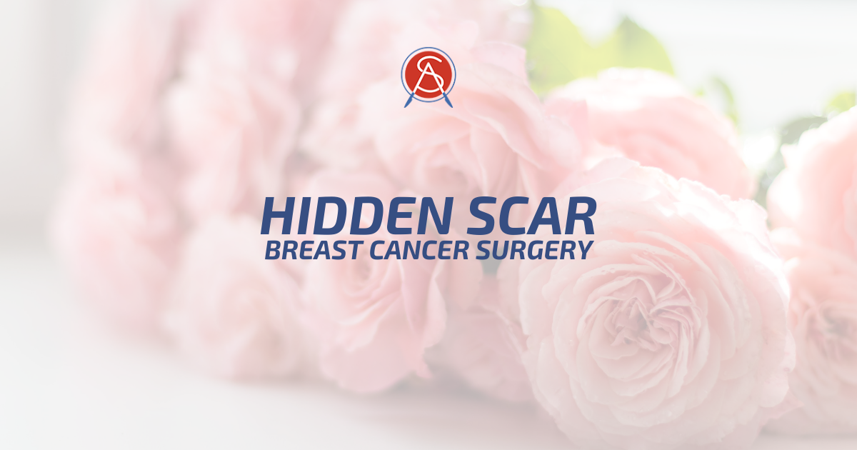 Dr. Dusty Smith Is Certified In Hidden Scar Breast Cancer Surgery