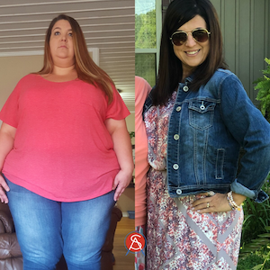 Jessica-Gastric-Sleeve-Before-After-163lb-Weight-Loss