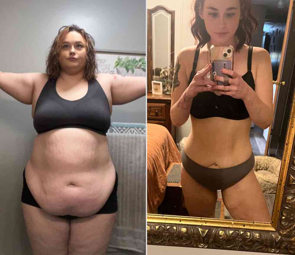 Patient Success Stories Bariatric General Surgery Testimonials